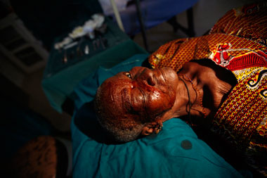 Photo of Mary Kelibilla following eye surgery, Ghana, Africa by Marielle van Uitert